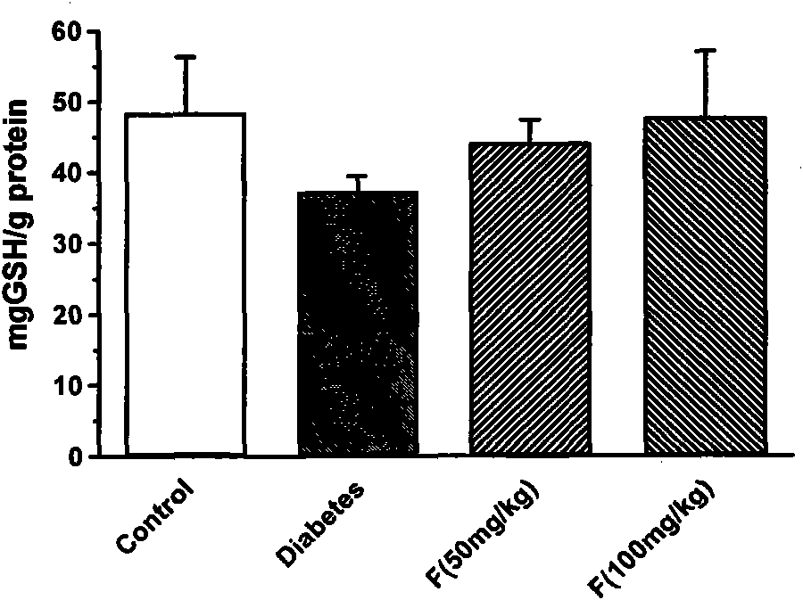 Application of alginate sulfuric ester in preparing drugs for preventing and treating diabetes and vascular diseases