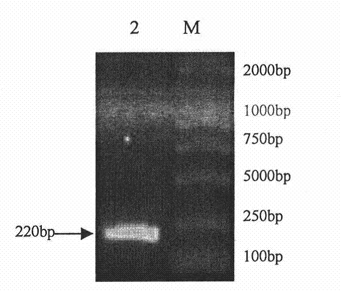 Recombinant adenovirus expressing mycoplasma hyopneumoniae P102 protein and applications thereof