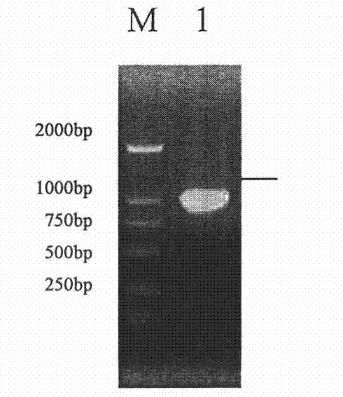 Recombinant adenovirus expressing mycoplasma hyopneumoniae P102 protein and applications thereof