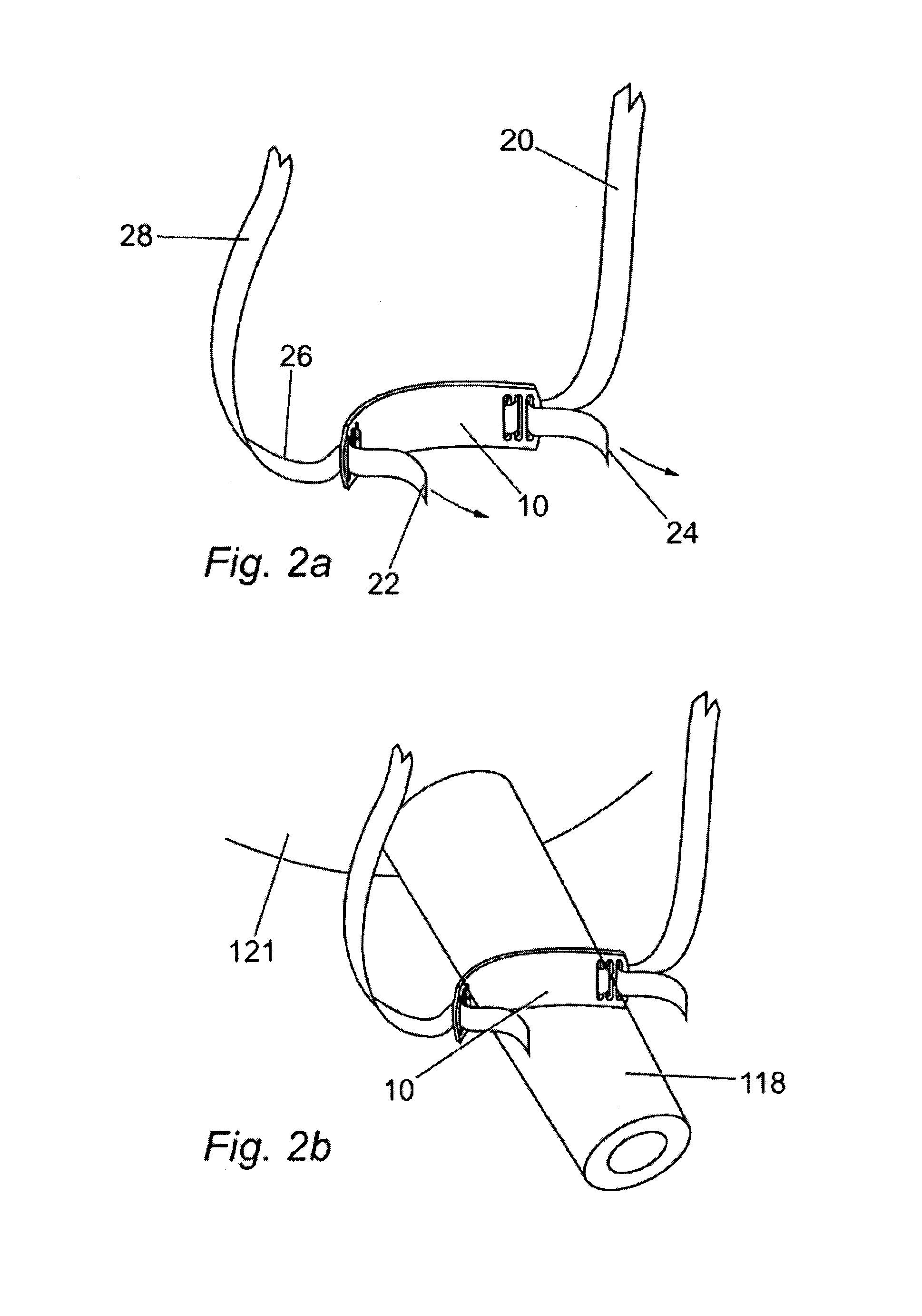 Method for fibrous anchoring of a pelvic support