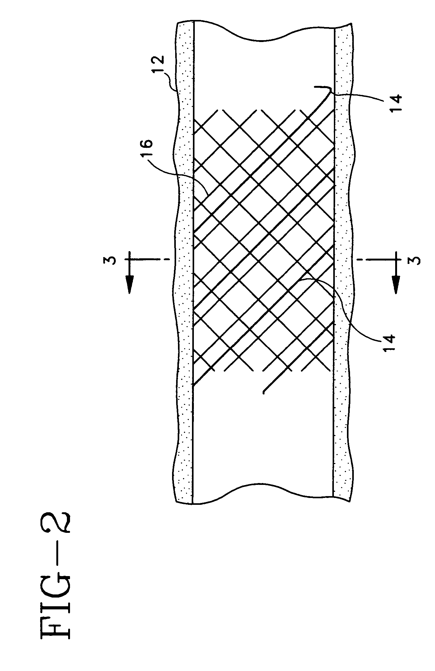 Bioabsorbable marker having radiopaque constituents