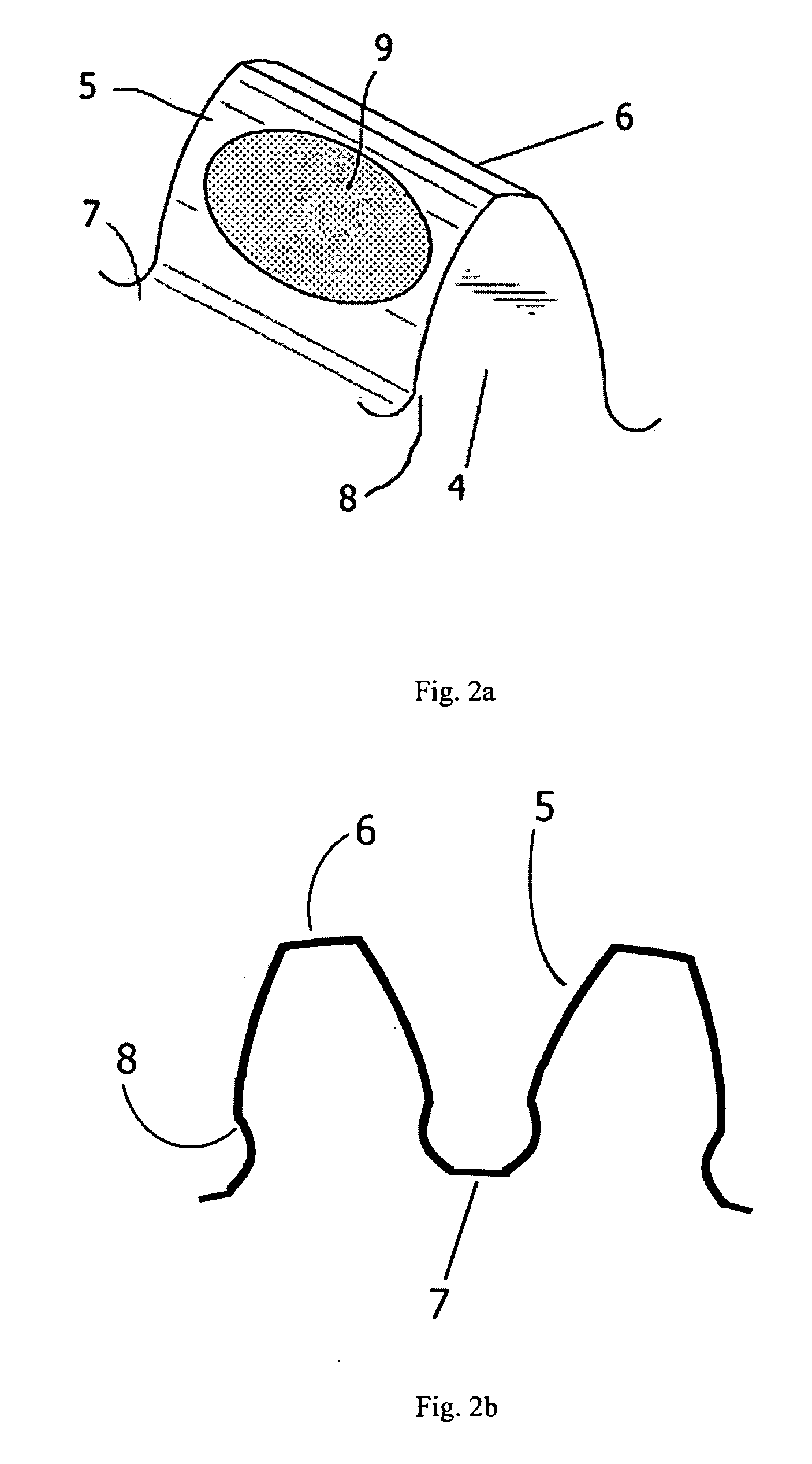 Superfinishing large planetary gear systems