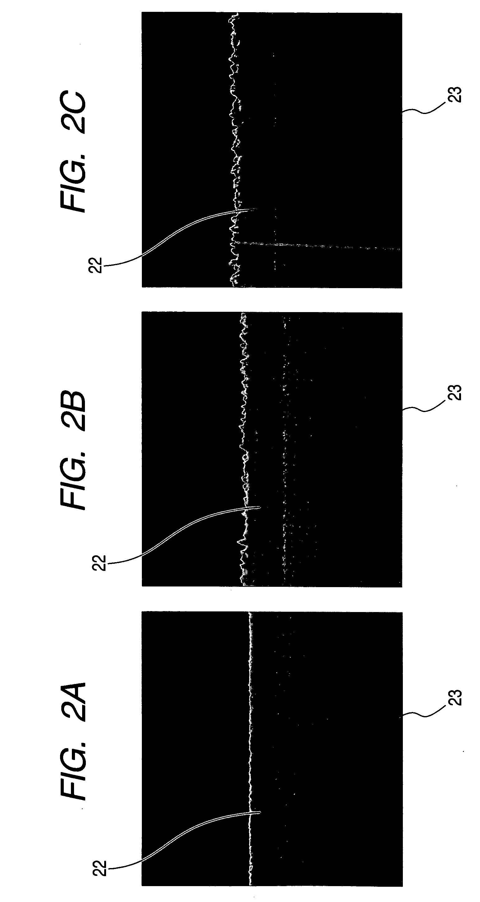 Dry etching method and apparatus