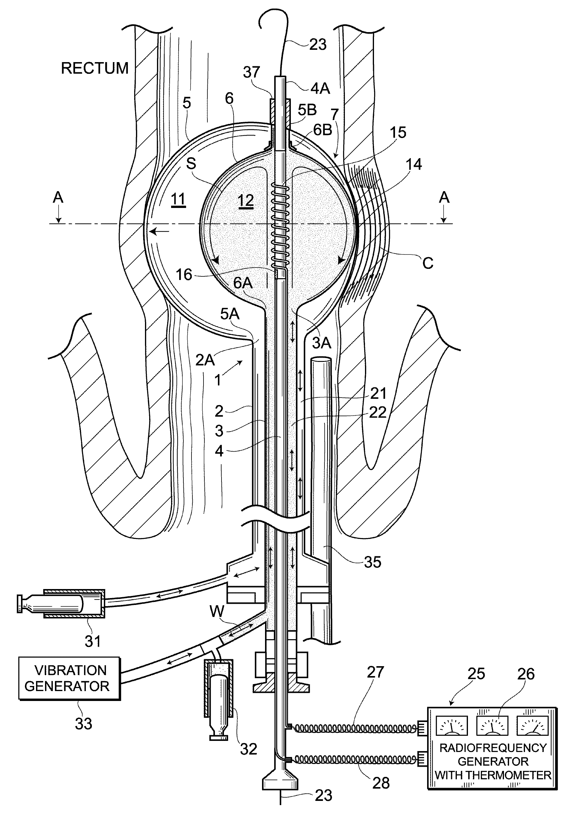 Balloon catheter