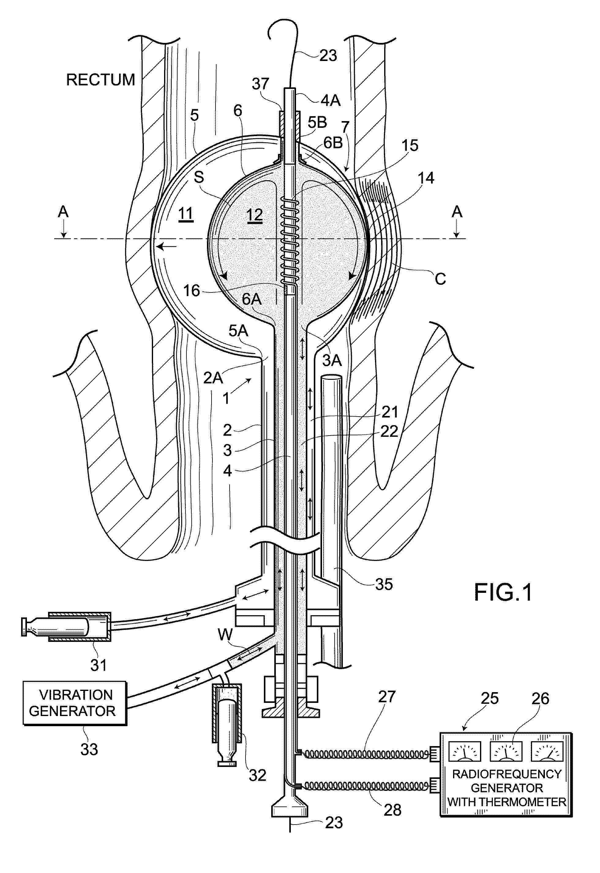 Balloon catheter