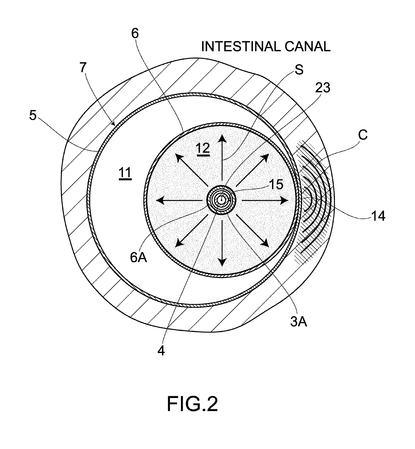 Balloon catheter