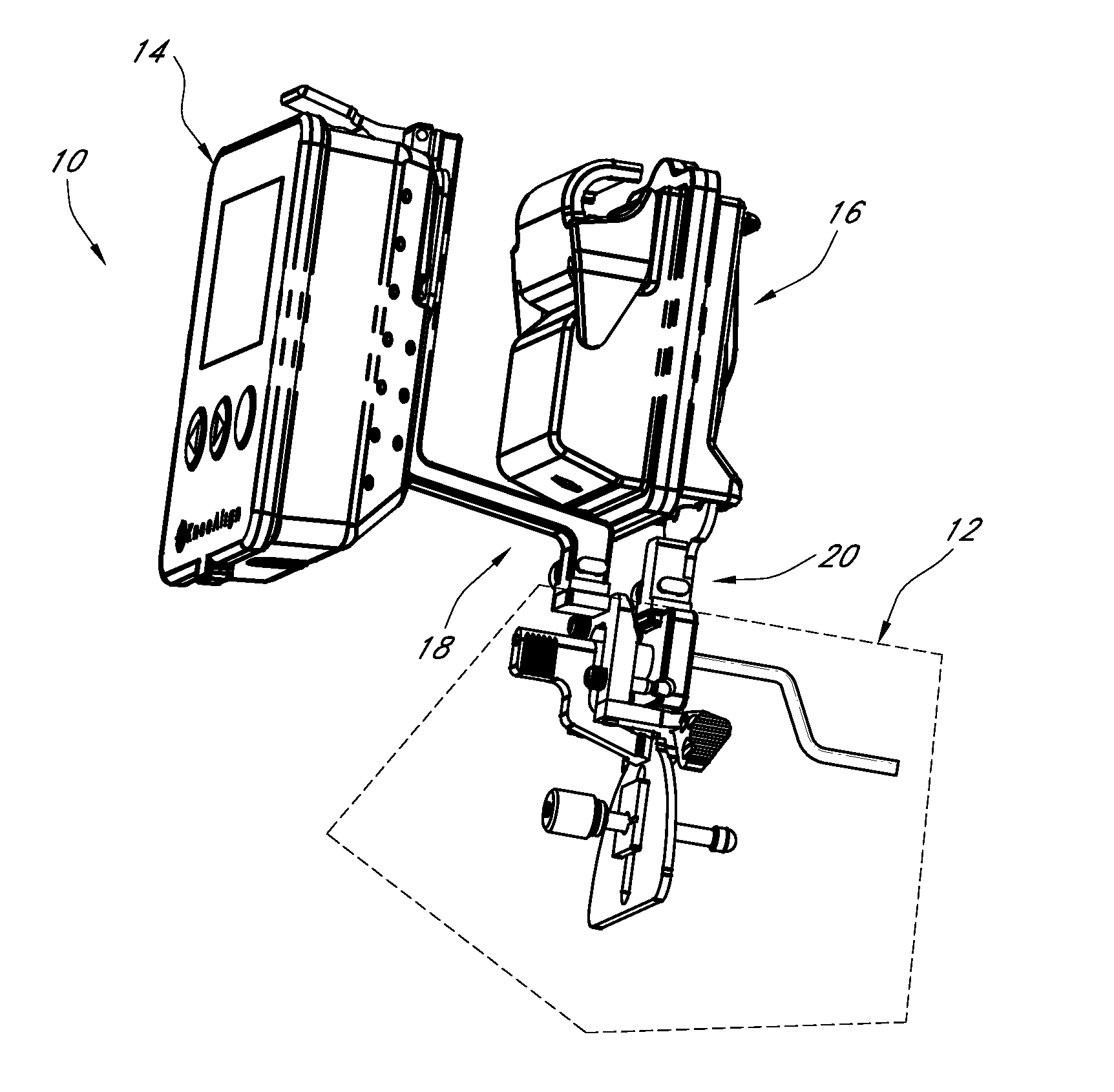 Systems and methods for joint replacement