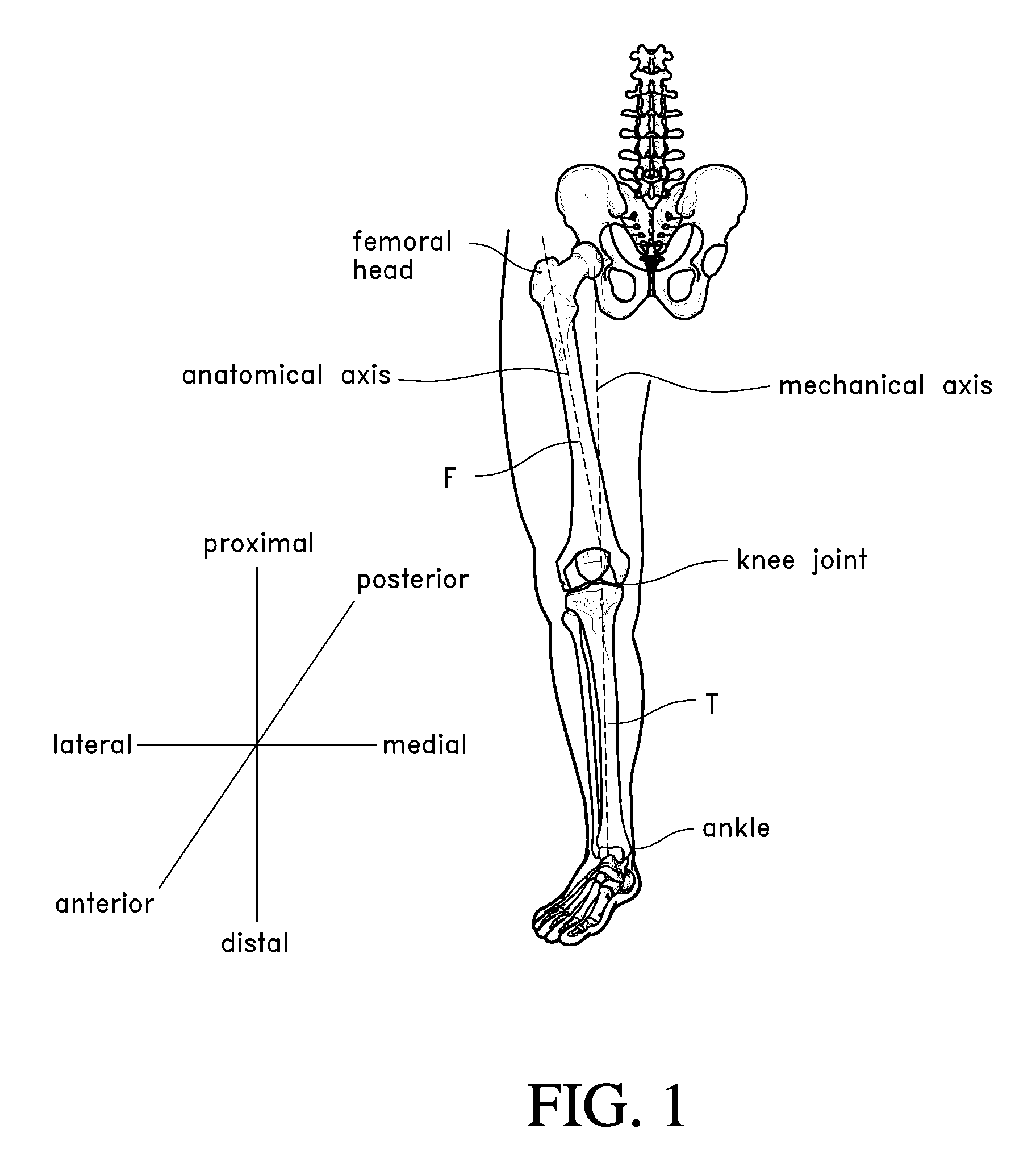 Systems and methods for joint replacement