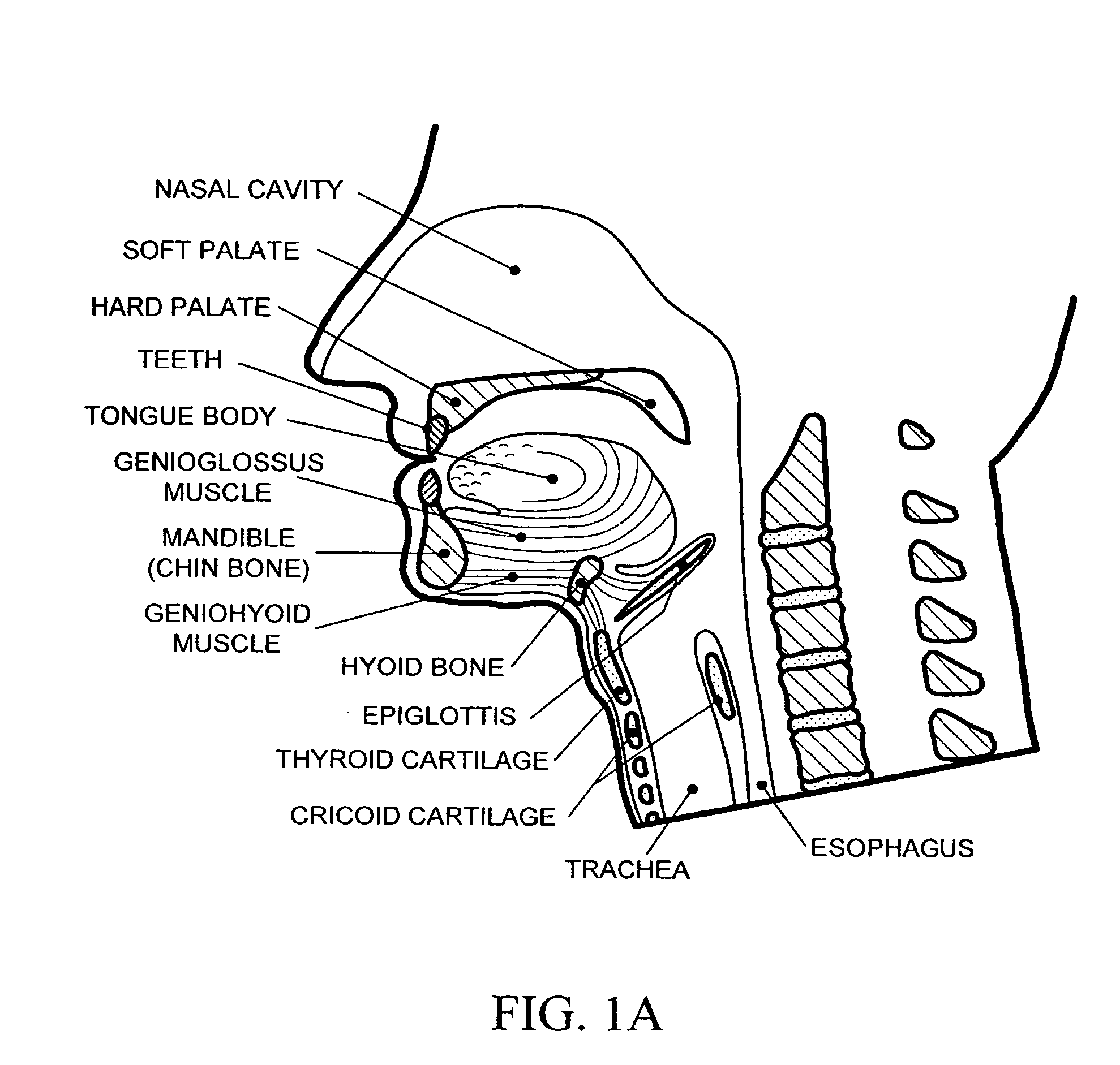 Devices and methods for treating sleep disorders