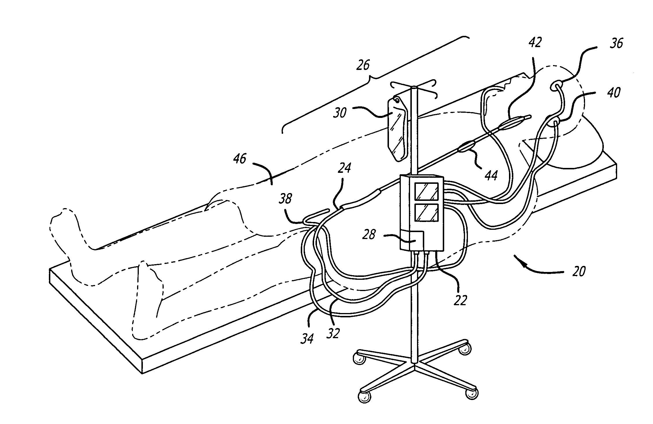 Apparatus and method for providing enhanced heat transfer from a body