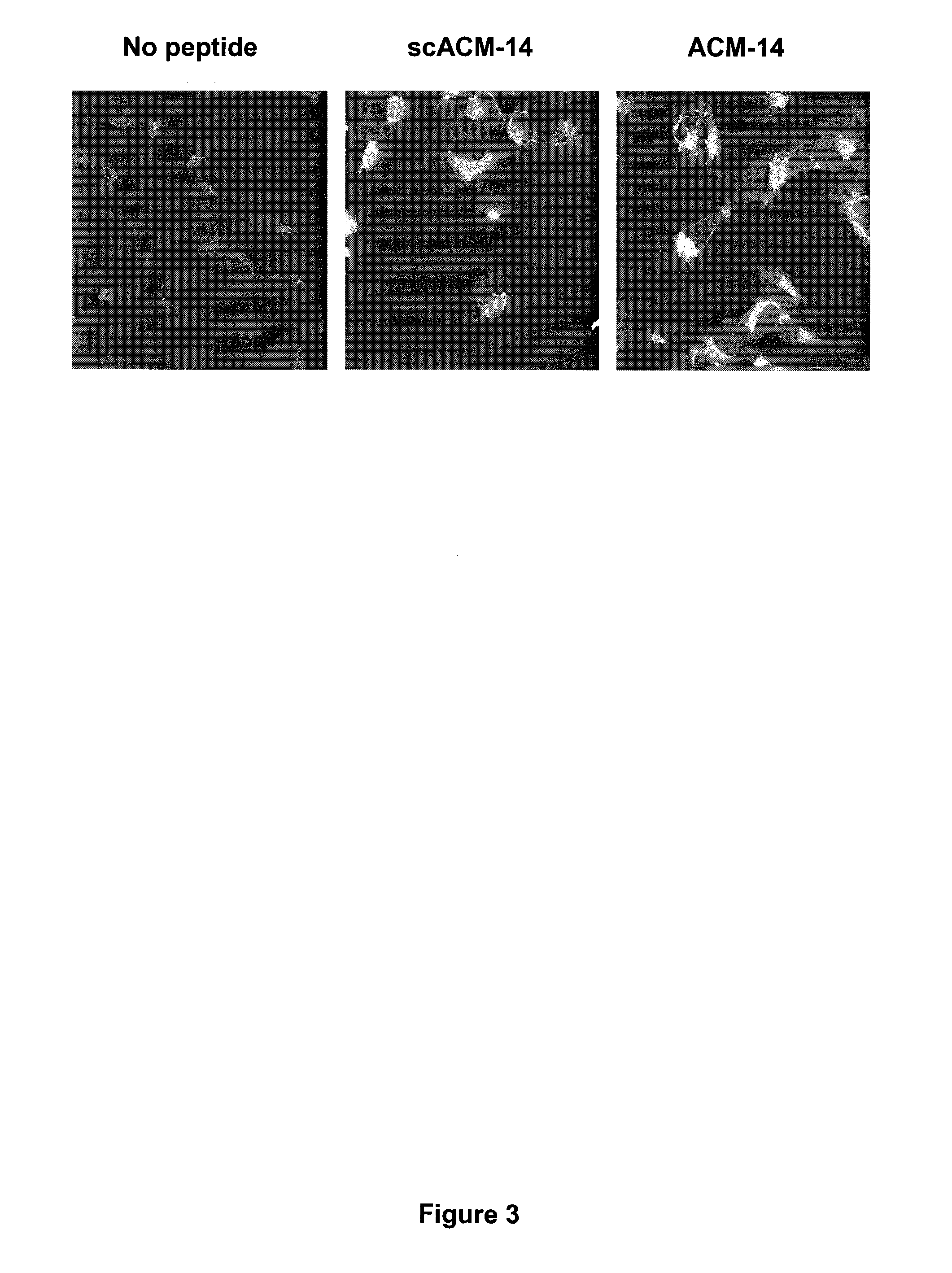 Membrane type-1 matrix metalloprotein inhibitors and uses thereof