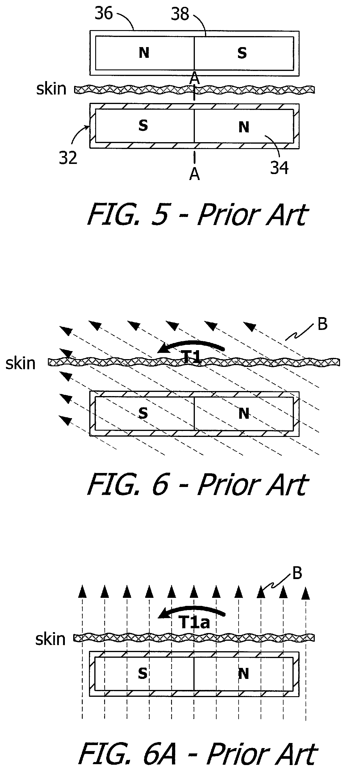 Cochlear implants having MRI-compatible magnet apparatus