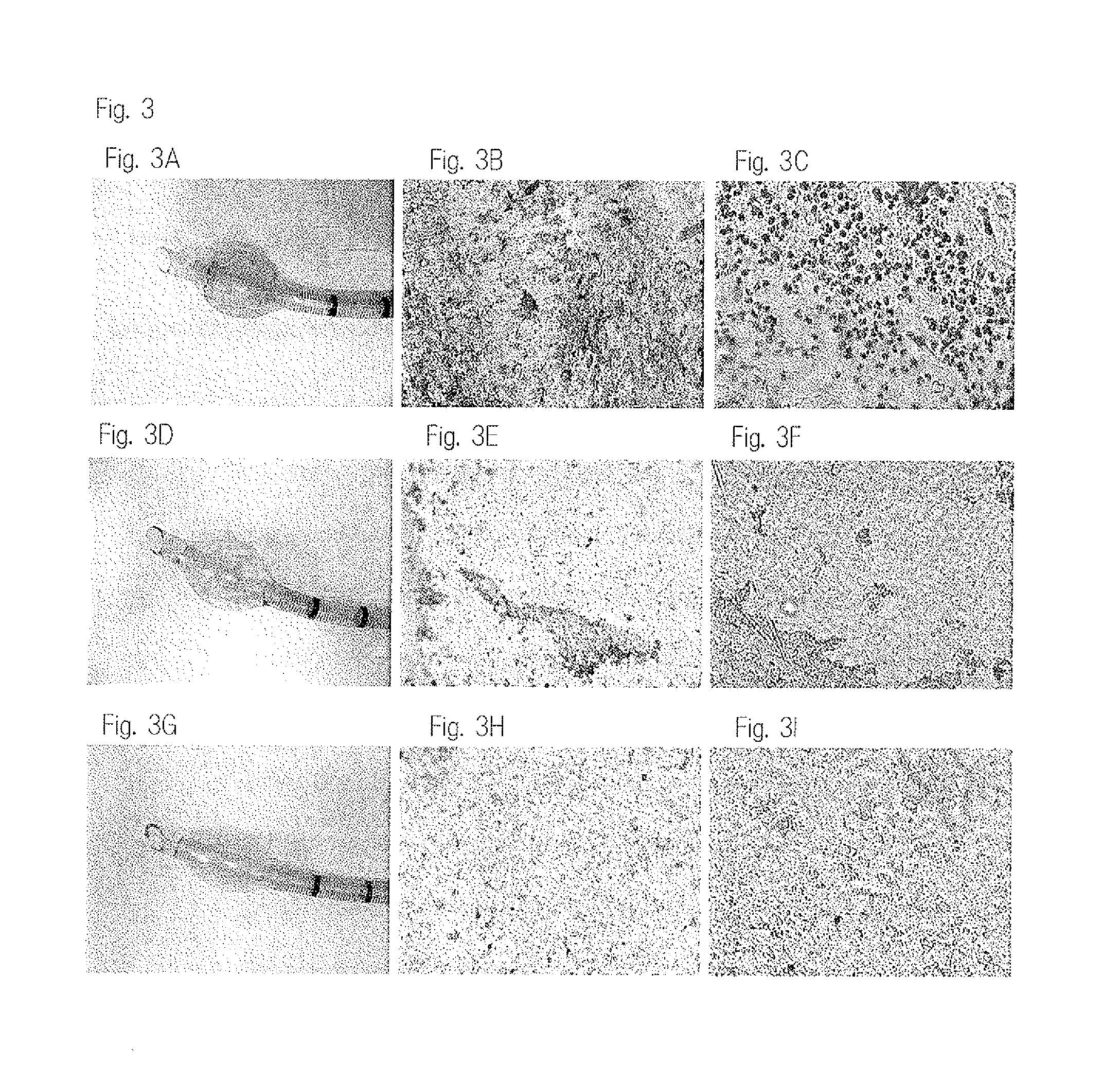 Resin product for medical use and respiration-assisting tube