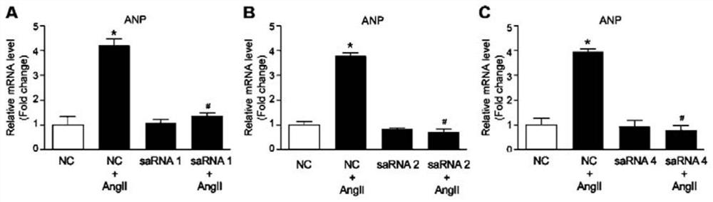 SaRNA for protecting myocardial cells from stress injury and application thereof