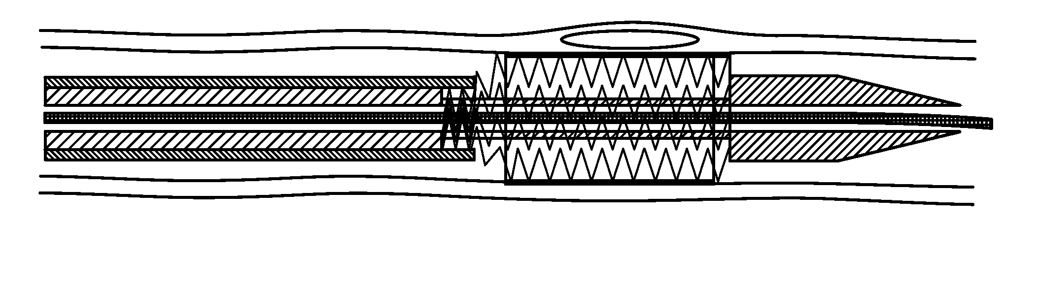 Conformable vascular prosthesis delivery system