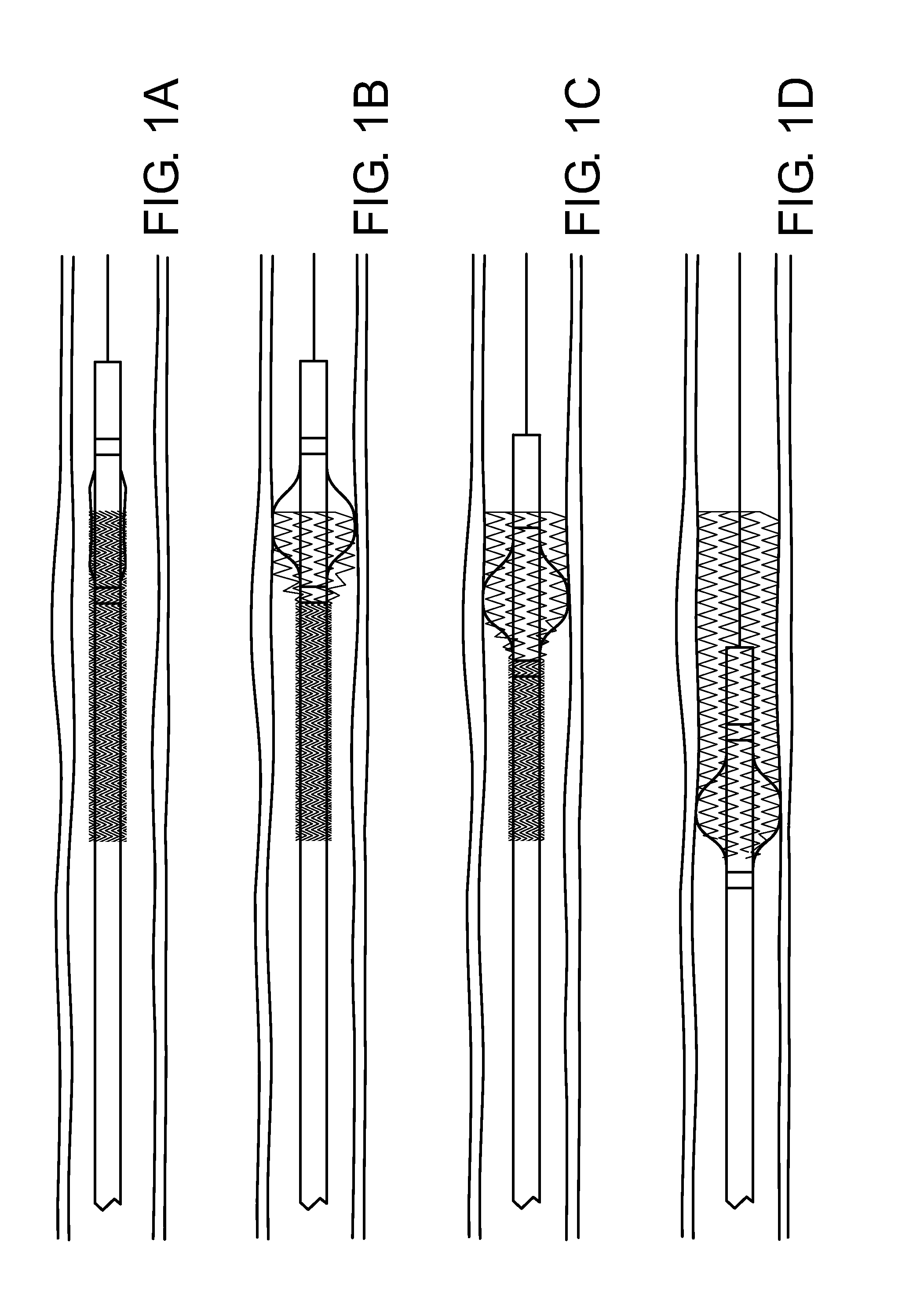 Conformable vascular prosthesis delivery system