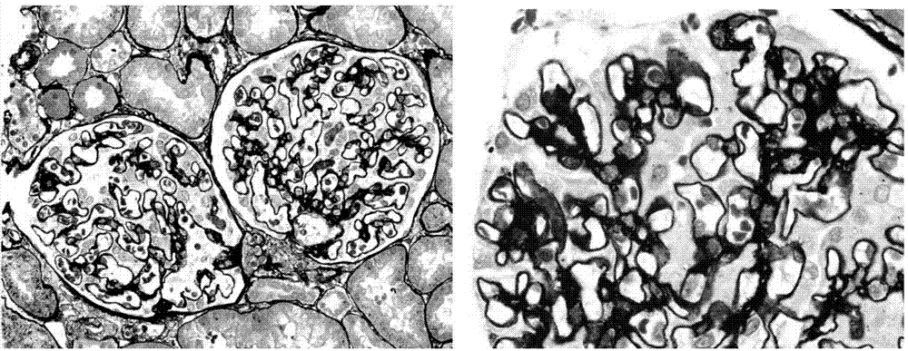 Improved methenamine silver-masson staining method