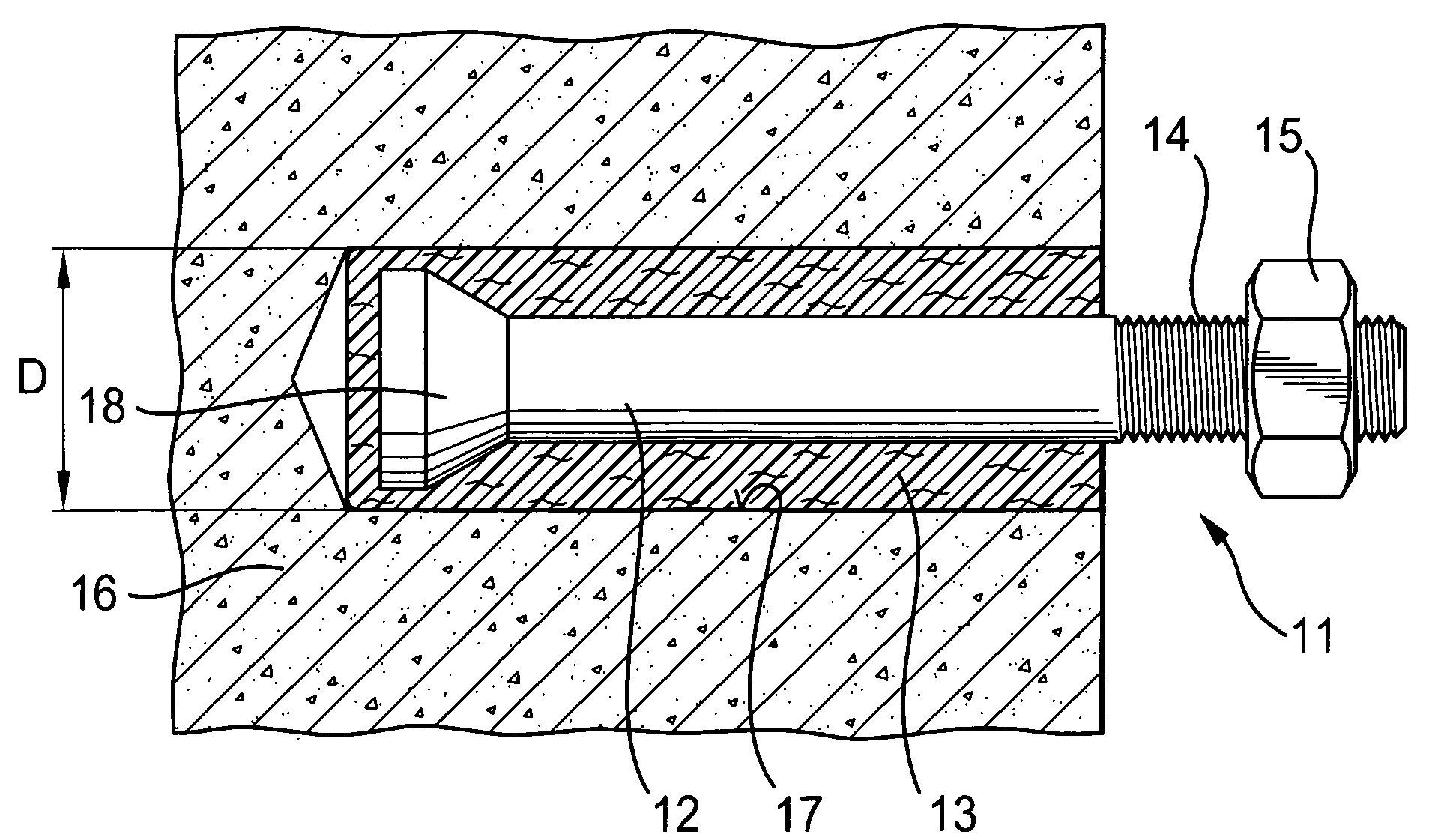 Anchor element