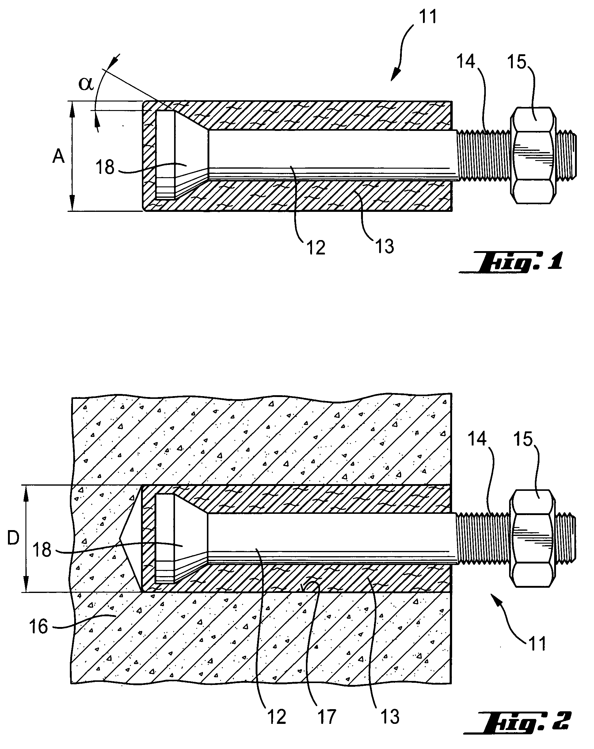 Anchor element