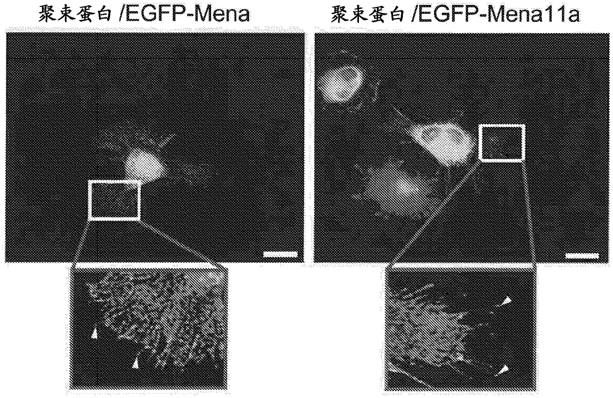 Methods and compositions for detecting and modulating cancer cells