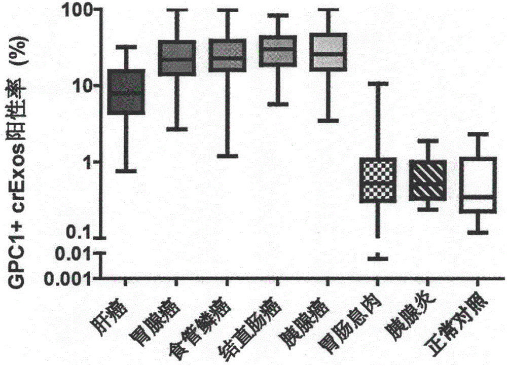 Application of GPC1 as tumor diagnosis marker