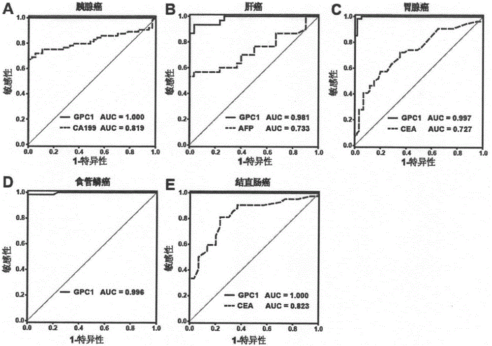 Application of GPC1 as tumor diagnosis marker