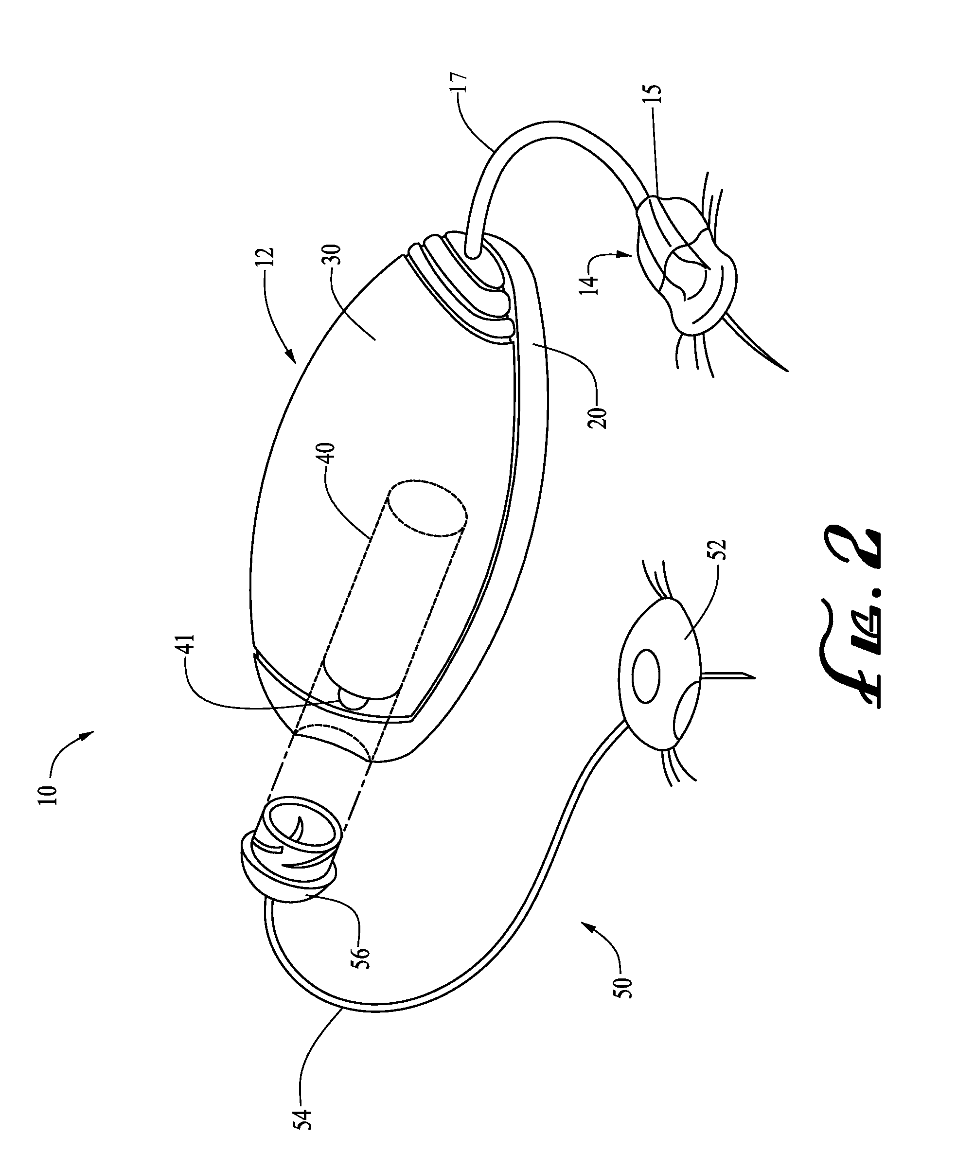 Reservoir barrier layer systems and methods