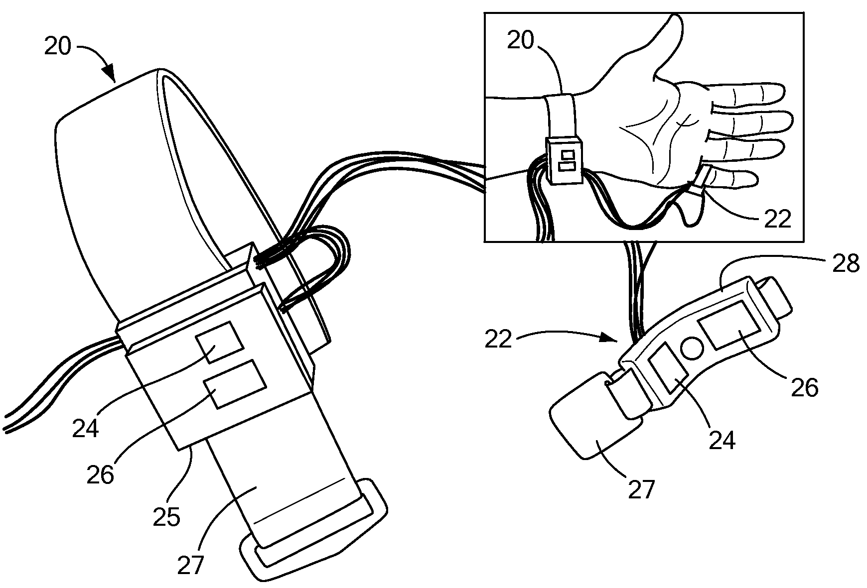 Calibration of Pulse Transit Time Measurements to Arterial Blood Pressure using External Arterial Pressure Applied along the Pulse Transit Path