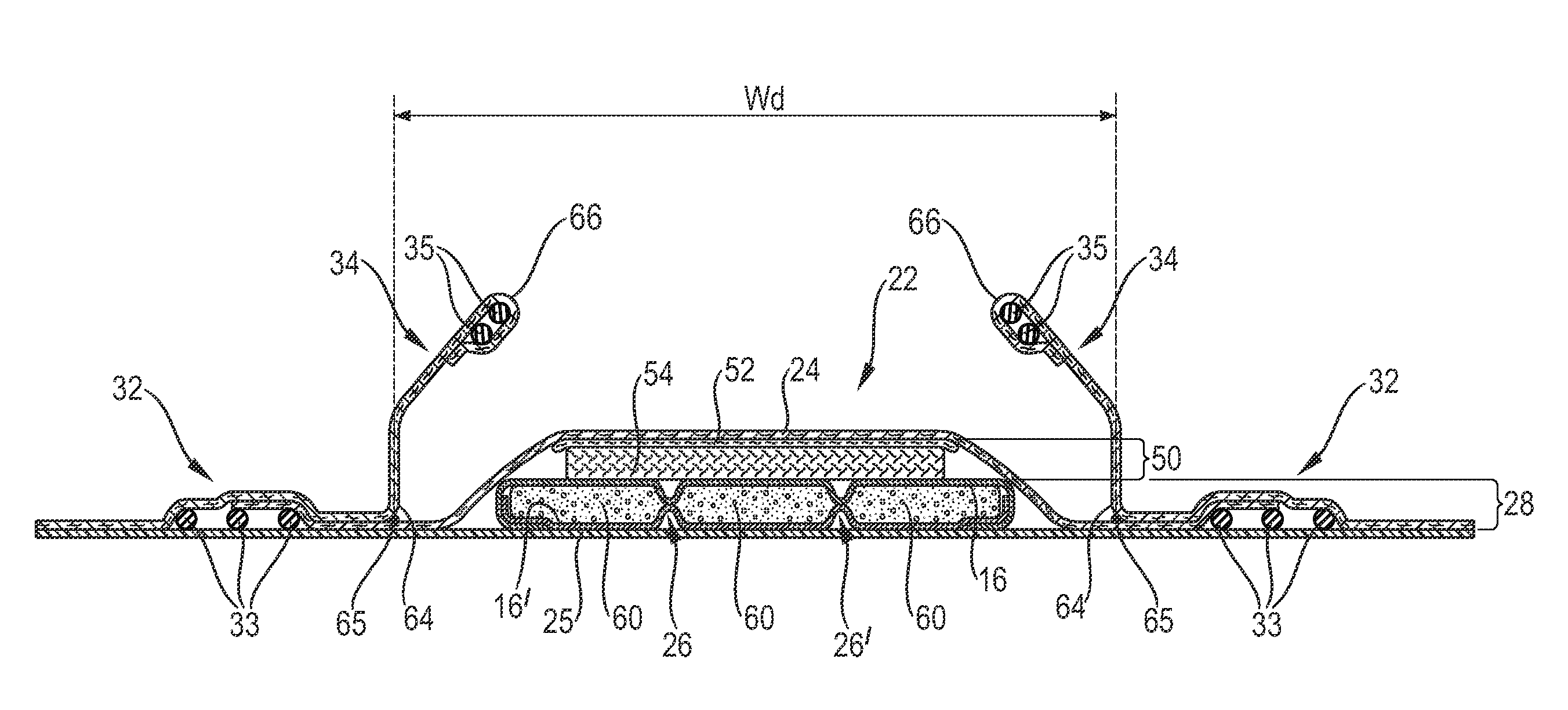 Absorbent article with high absorbent material content