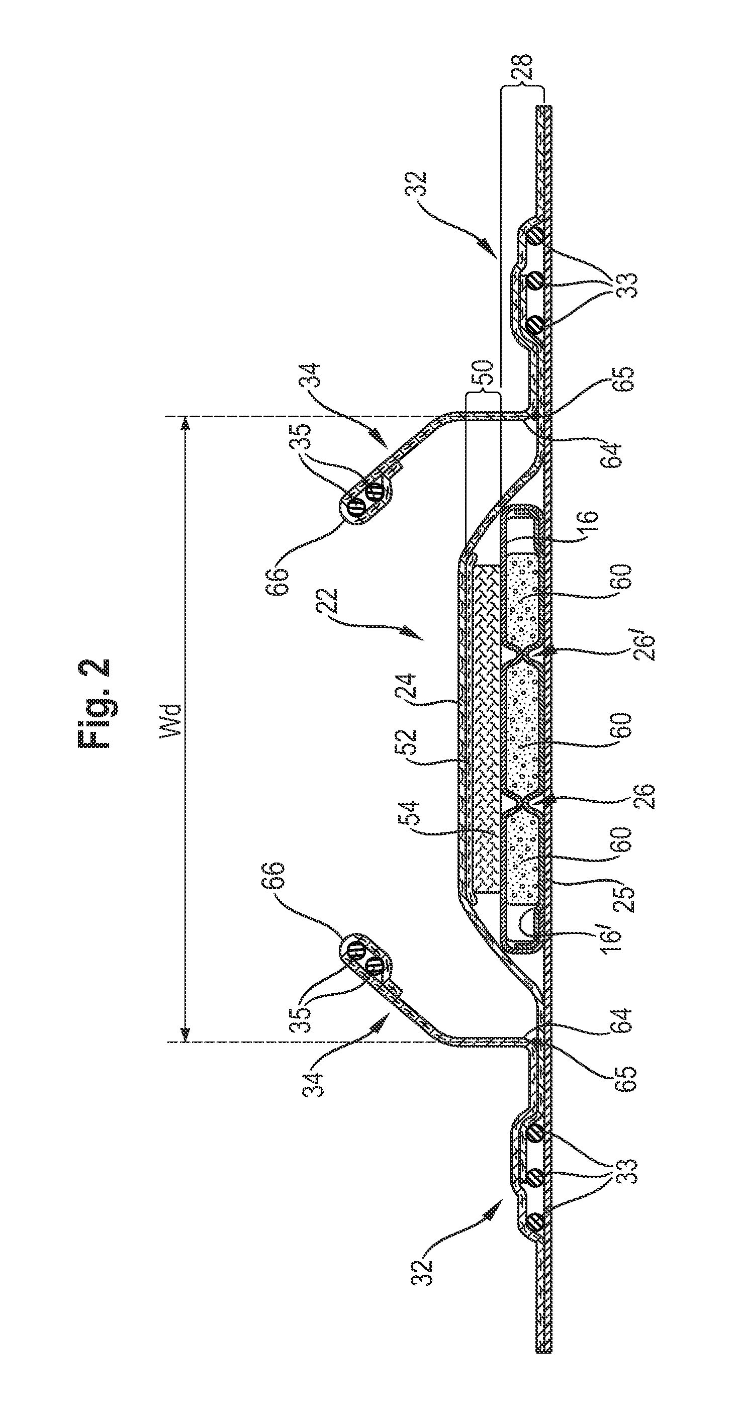 Absorbent article with high absorbent material content