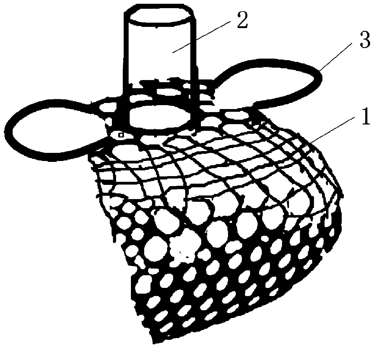 Titanium mesh device with individualized bone ridge regeneration titanium mesh, for accurate implant tooth repairing operation and manufacturing method of titanium mesh device