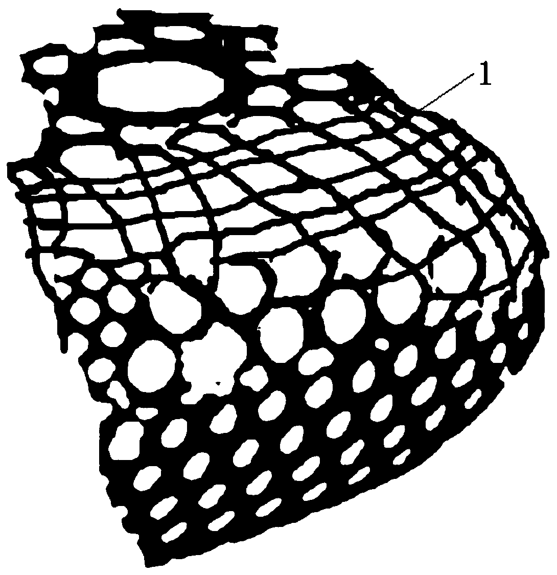 Titanium mesh device with individualized bone ridge regeneration titanium mesh, for accurate implant tooth repairing operation and manufacturing method of titanium mesh device