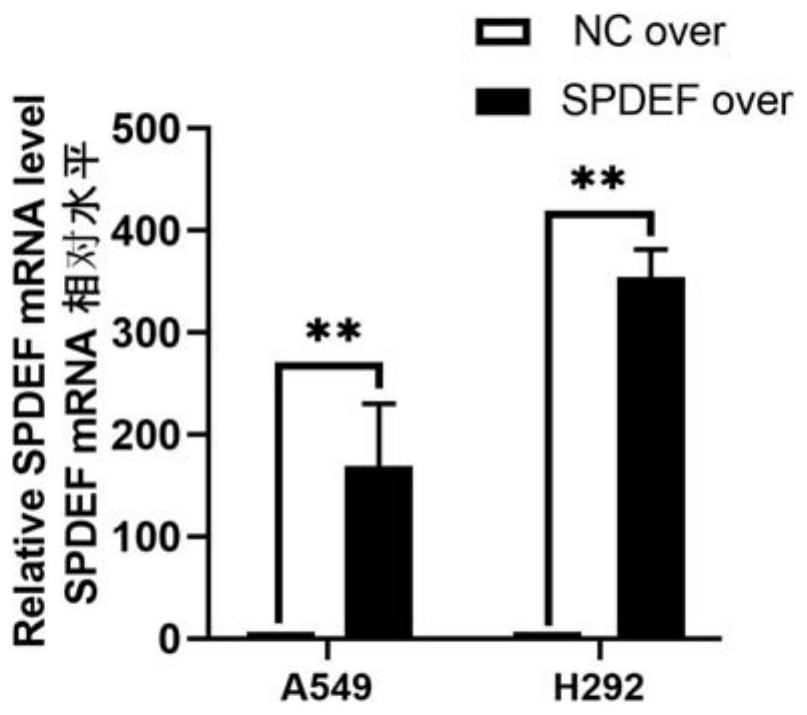 Application of SPDEF gene inhibitor in preparation of medicine for enhancing sensitivity of lung mucus adenocarcinoma cells to cis-platinum