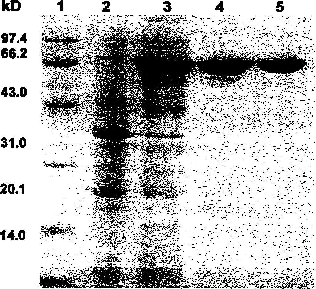 Preparation of oligomeric xylose and alpha-glucuronylic enzyme used therefor