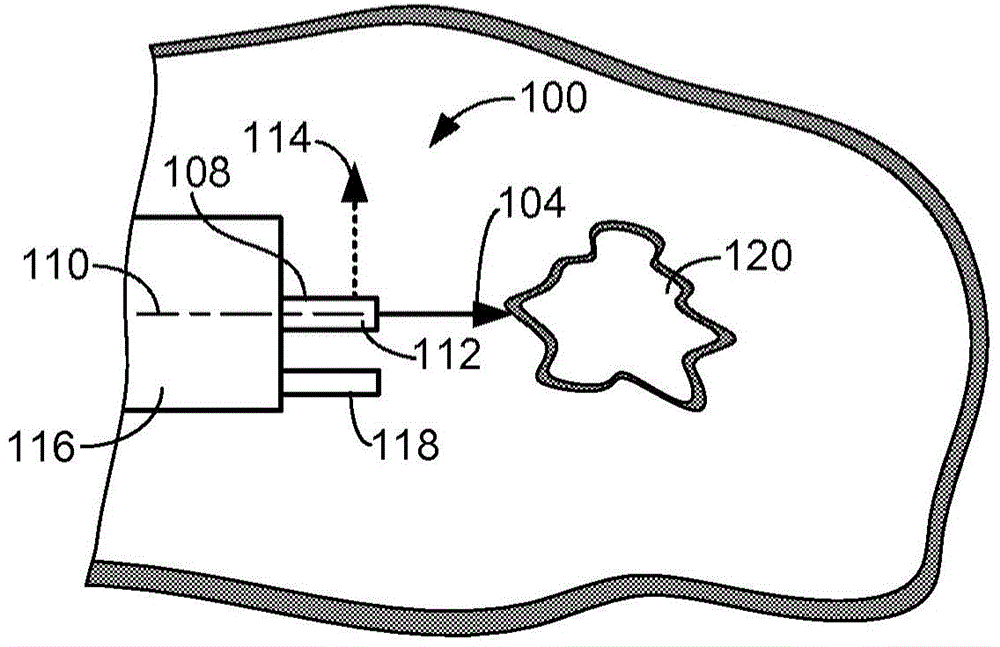 Surgical laser systems and laser lithotripsy techniques