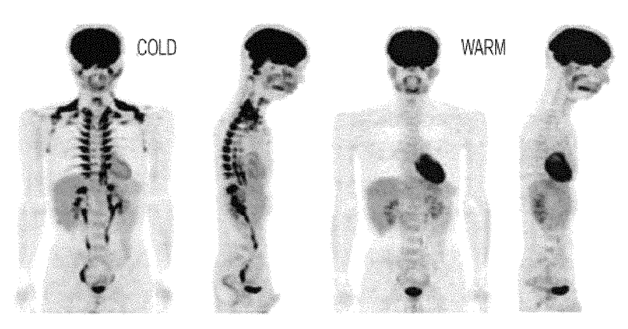 Methods and devices for activating brown adipose tissue using electrical energy