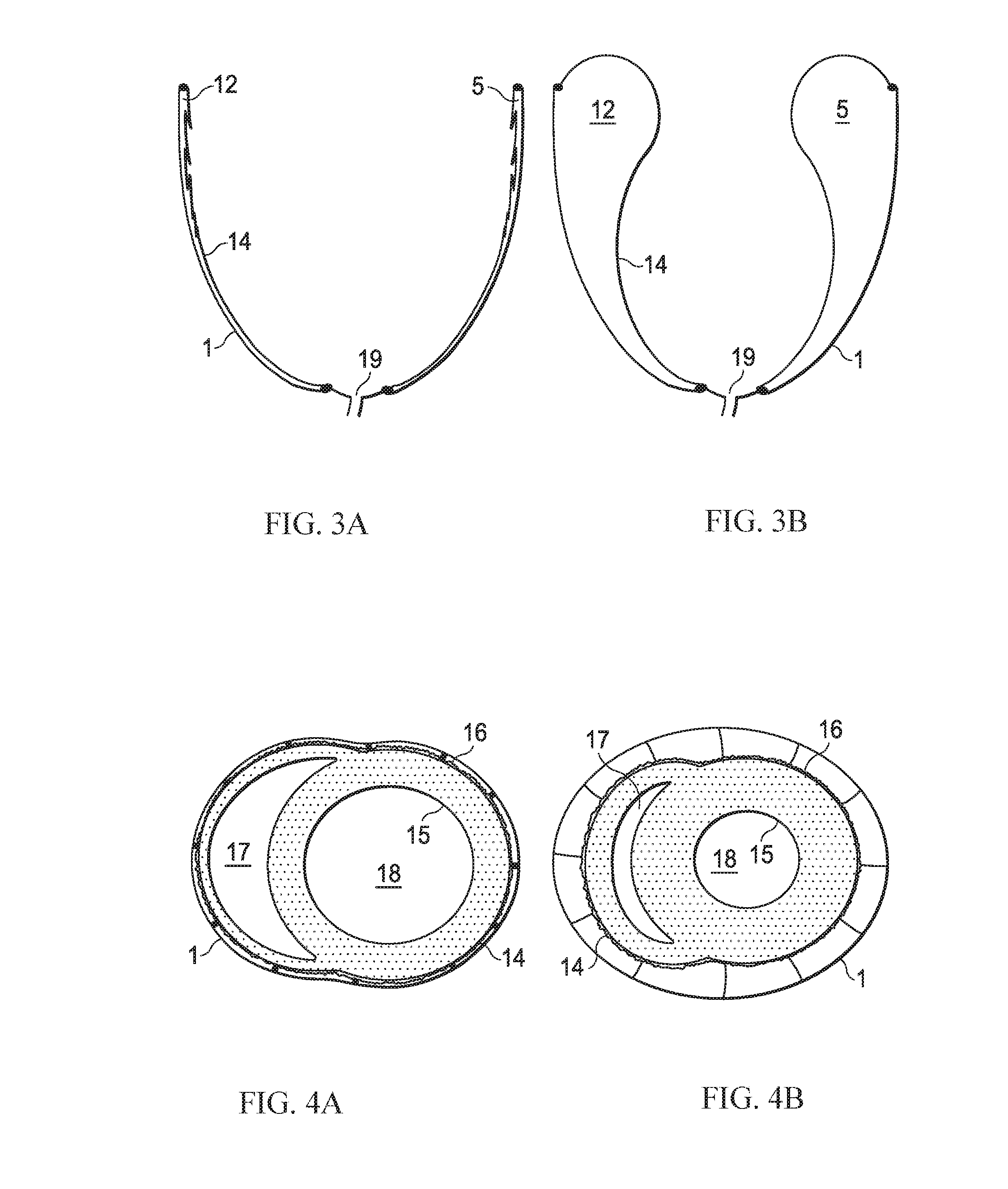 Fully implantable direct cardiac and aortic compression device