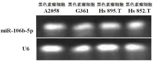 Construction method and application of human miR-106b-5p interference fragment