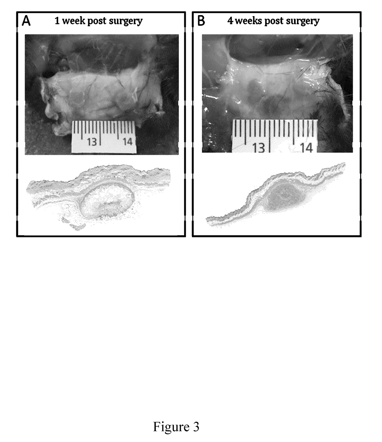 Decellularised cell wall structures from plants and fungus and use thereof as scaffold materials