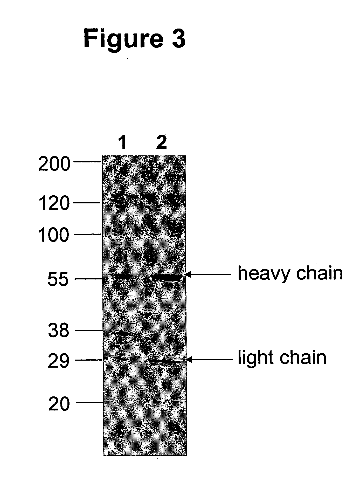 Immunoglobulins comprising predominantly a GalGlcNAcMan5GLcNAc2 glycoform