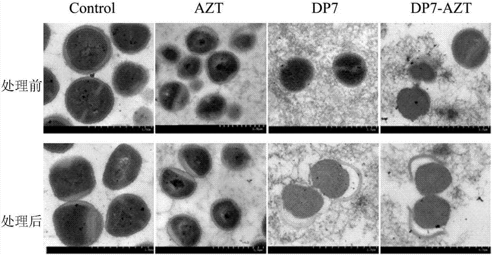 Antibacterial peptide and antibiotic combined antibacterial drug and use method thereof