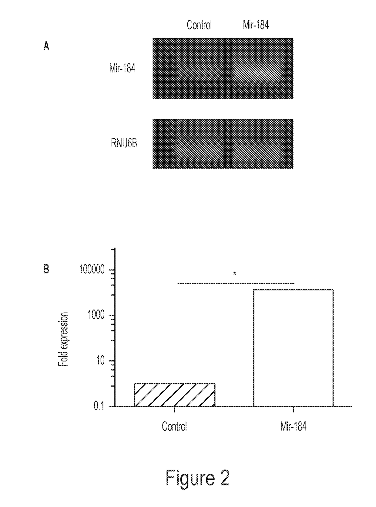 Modulation of microrna 184 to treat pathological lymphangiogenesis