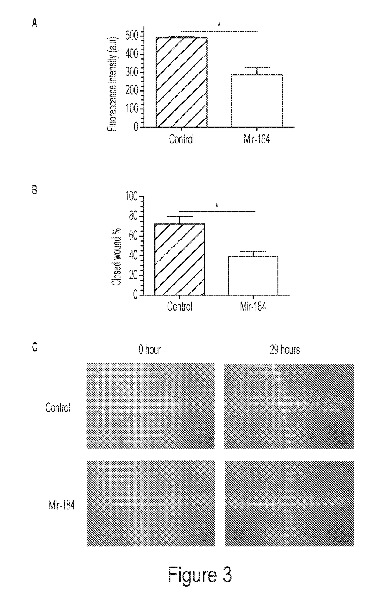 Modulation of microrna 184 to treat pathological lymphangiogenesis