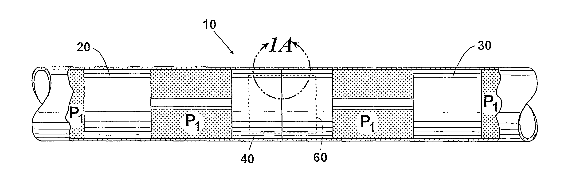 Internal composite repair apparatus