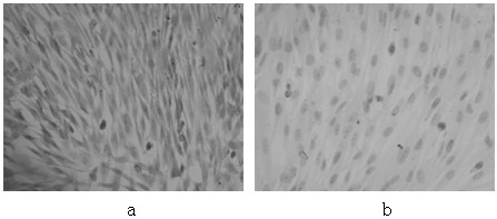 Method for sequential culture of human umbilical cord blood mesenchymal stem cells by using two culture media