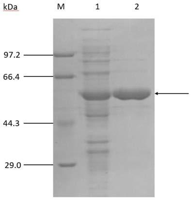 Cholesterol oxidase and application thereof