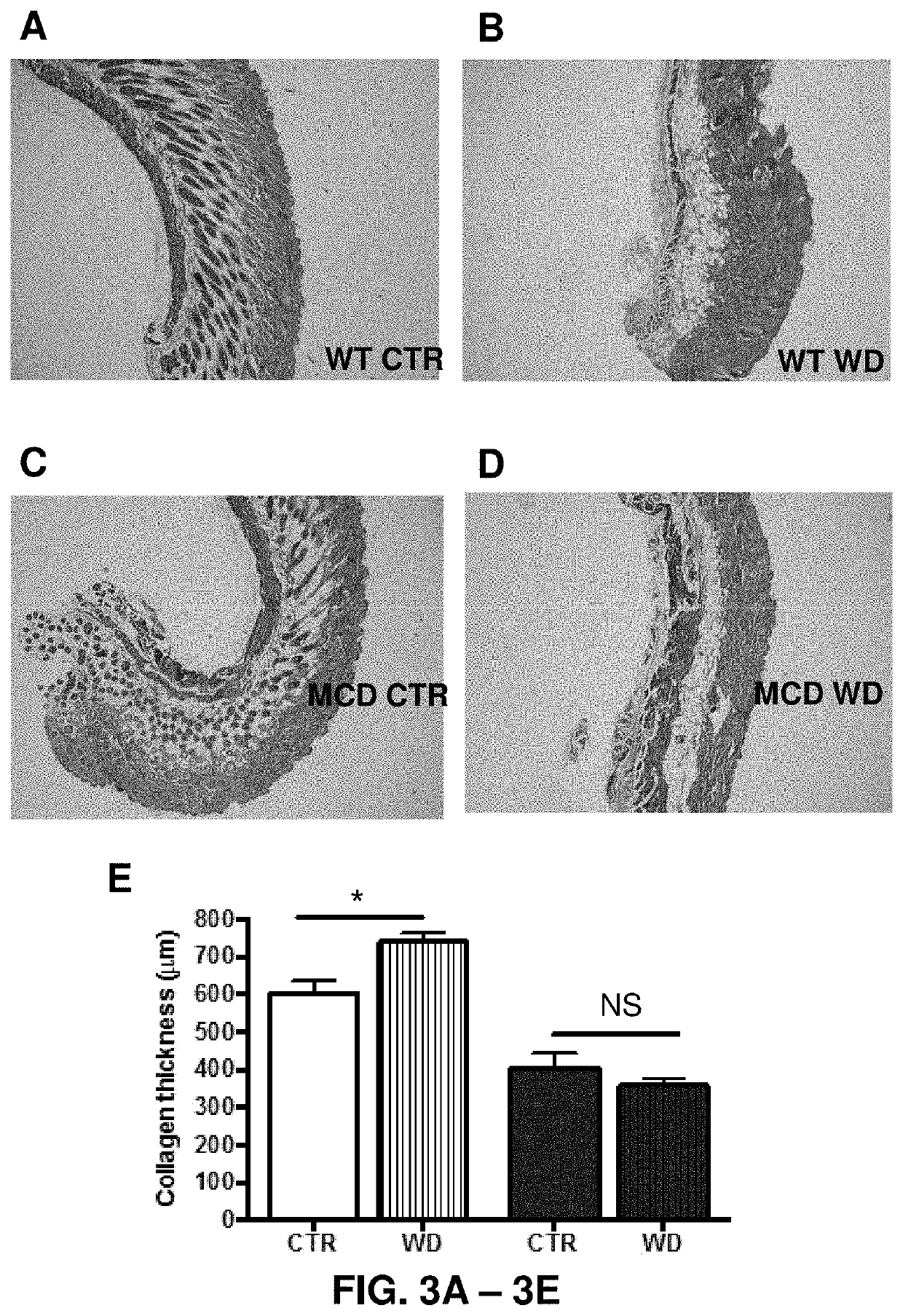 Methods for reducing abnormal scar formation