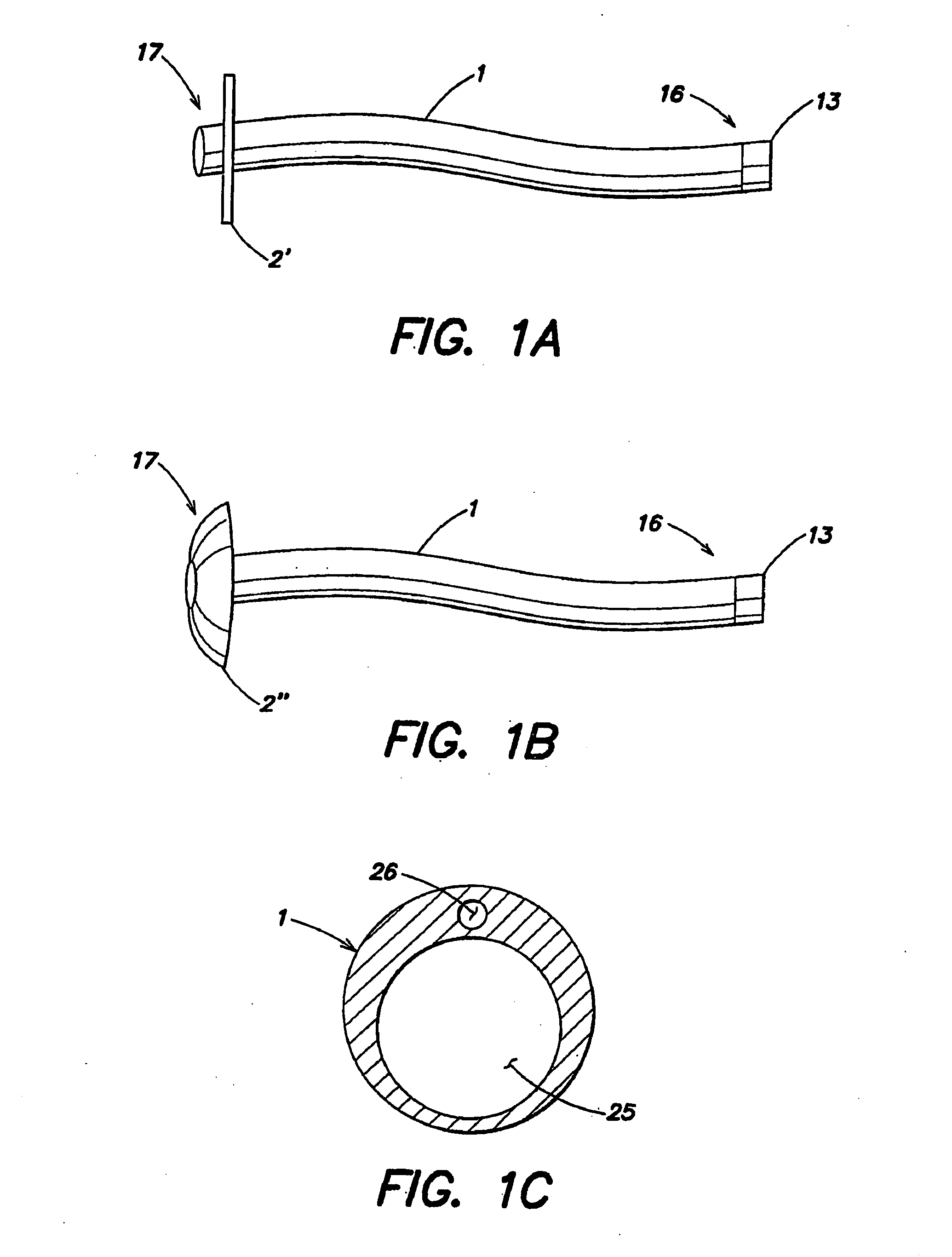 Method for treating obesity by extracting food