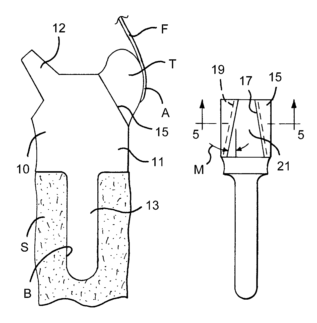 Soft tissue attachment system and method