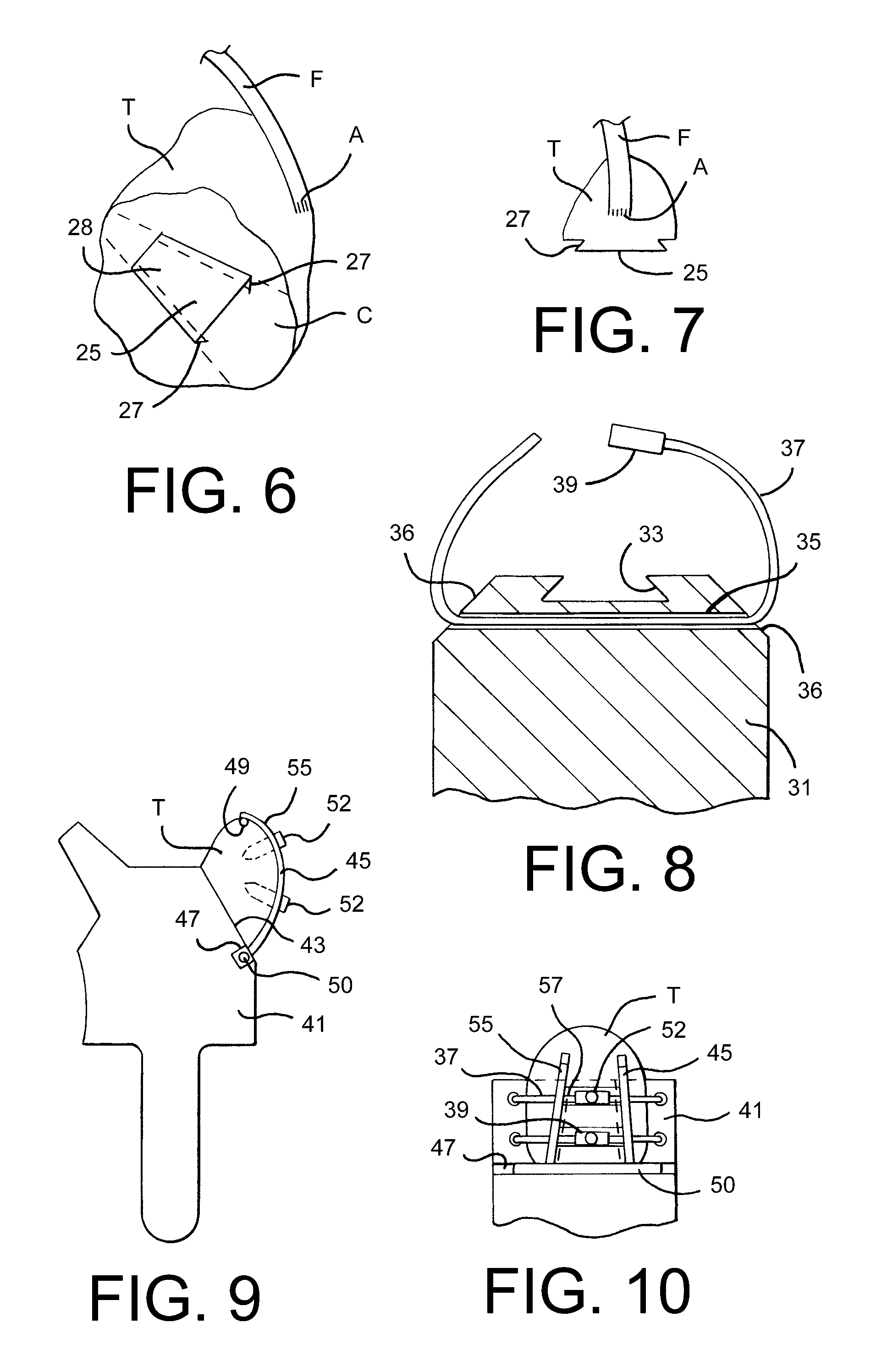 Soft tissue attachment system and method